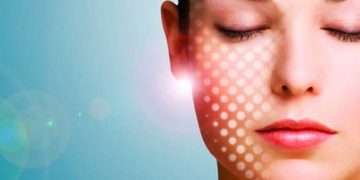 Fotos vor und nach der Laser-Gesichtserneuerung