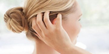 Wie kann man juckende Kopfhaut lindern?